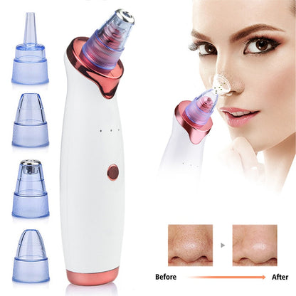Professional Electric Vacuum Facial Blackhead Remover