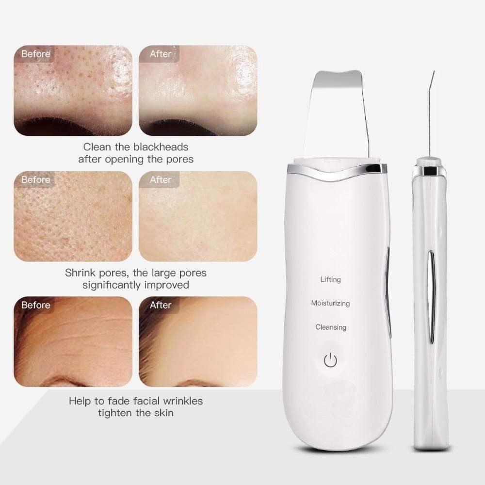 Ultrasonic Deep Facial Skin Scrubber & Ion Infuser